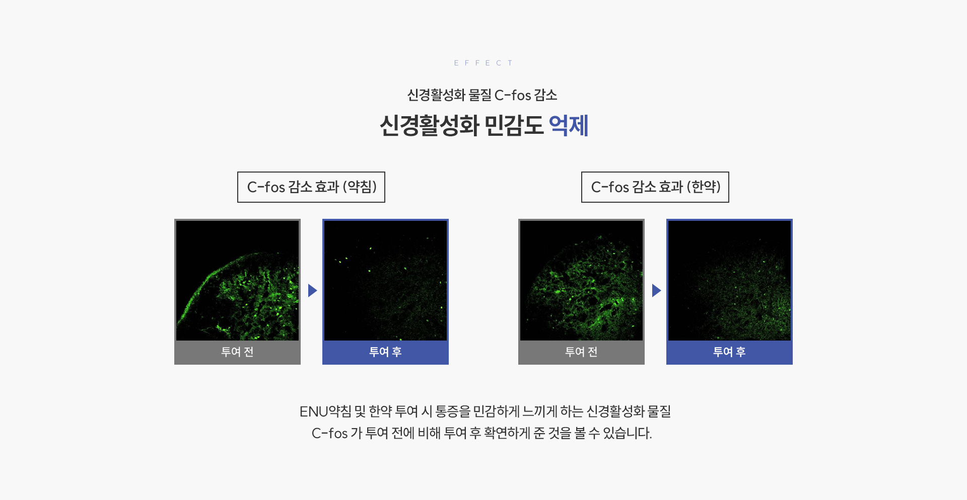 ENU 약침·한약 상세04