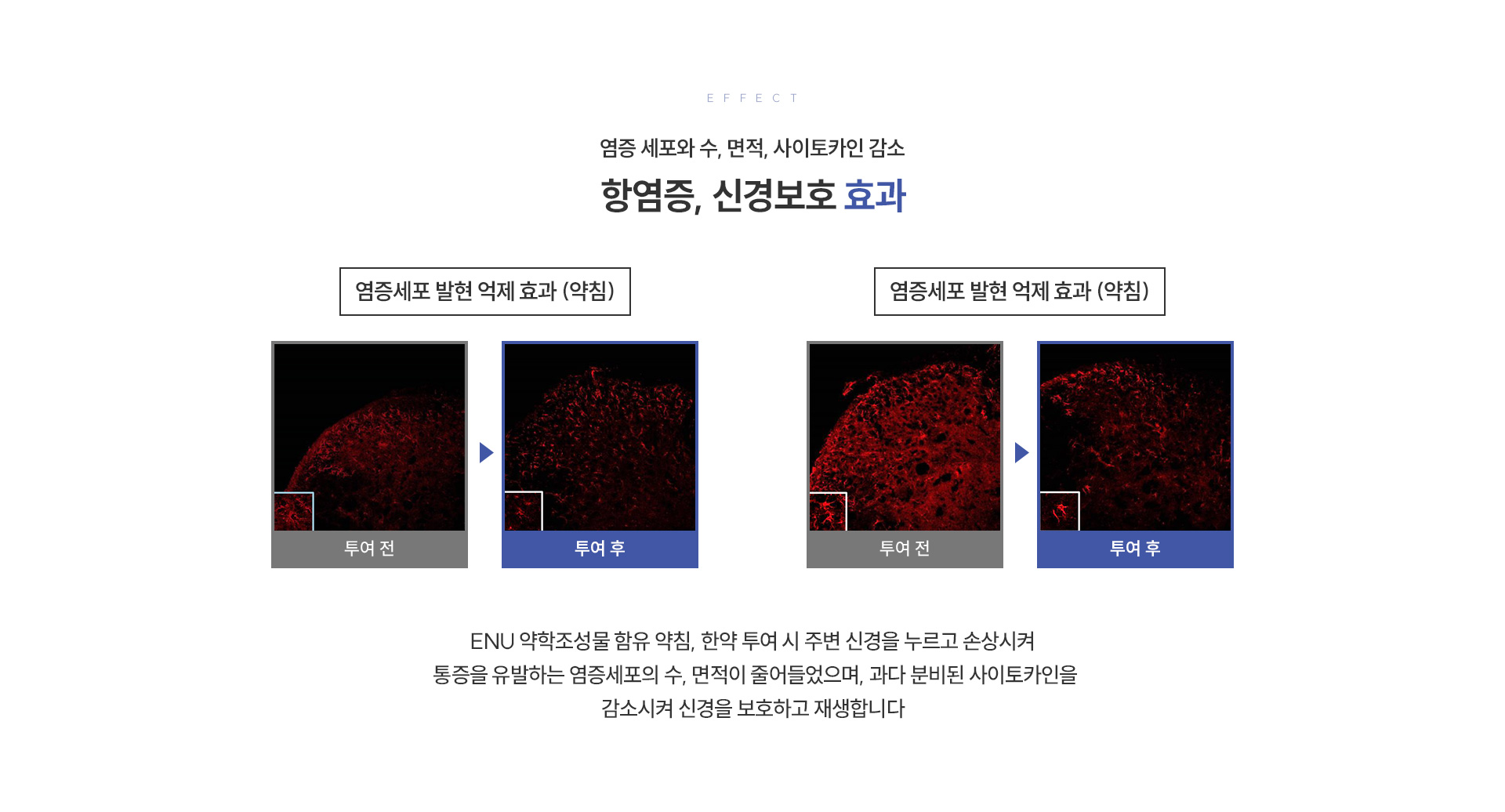 ENU 약침·한약 상세05